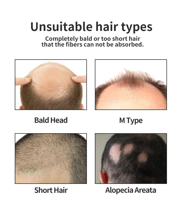 BUNEE Hair Fiber Set – 15g Hair Thickening Powder for Men