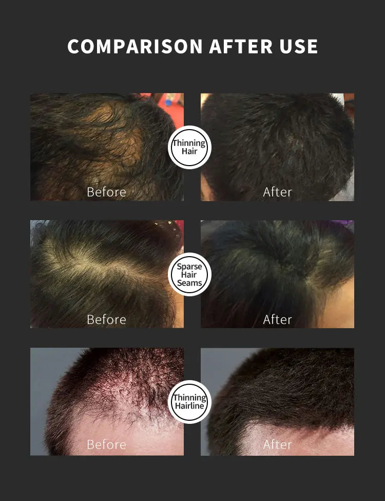 BUNEE Hair Fiber Set – 15g Hair Thickening Powder for Men