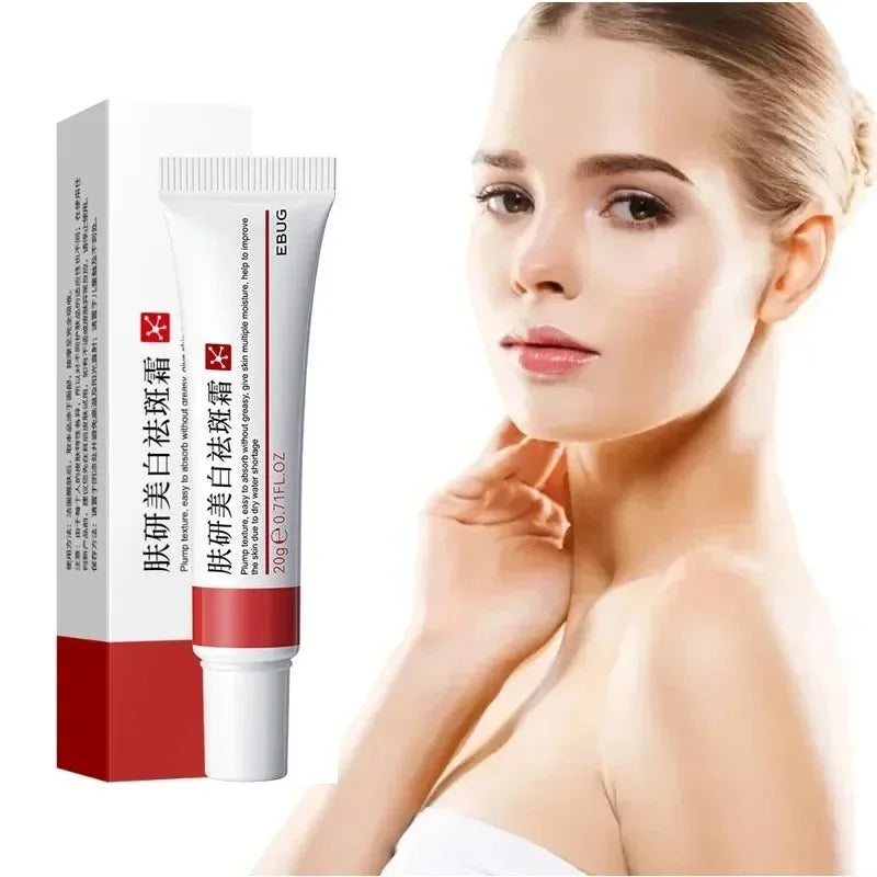 Whitening Freckle Cream – Dark Spot Remover with Niacinamide