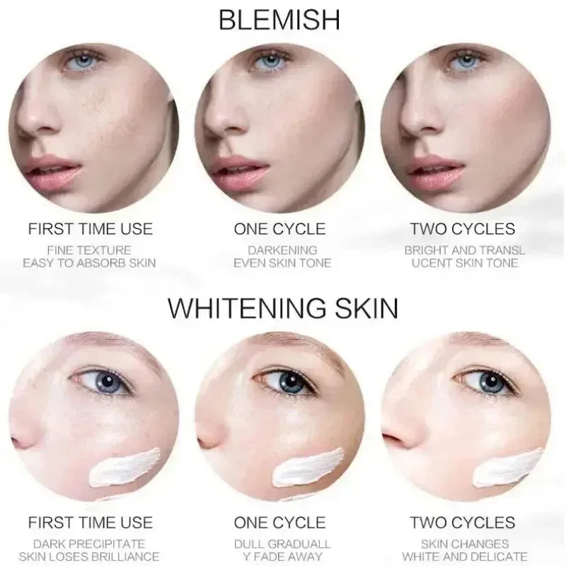 Whitening Freckle Cream – Dark Spot Remover with Niacinamide