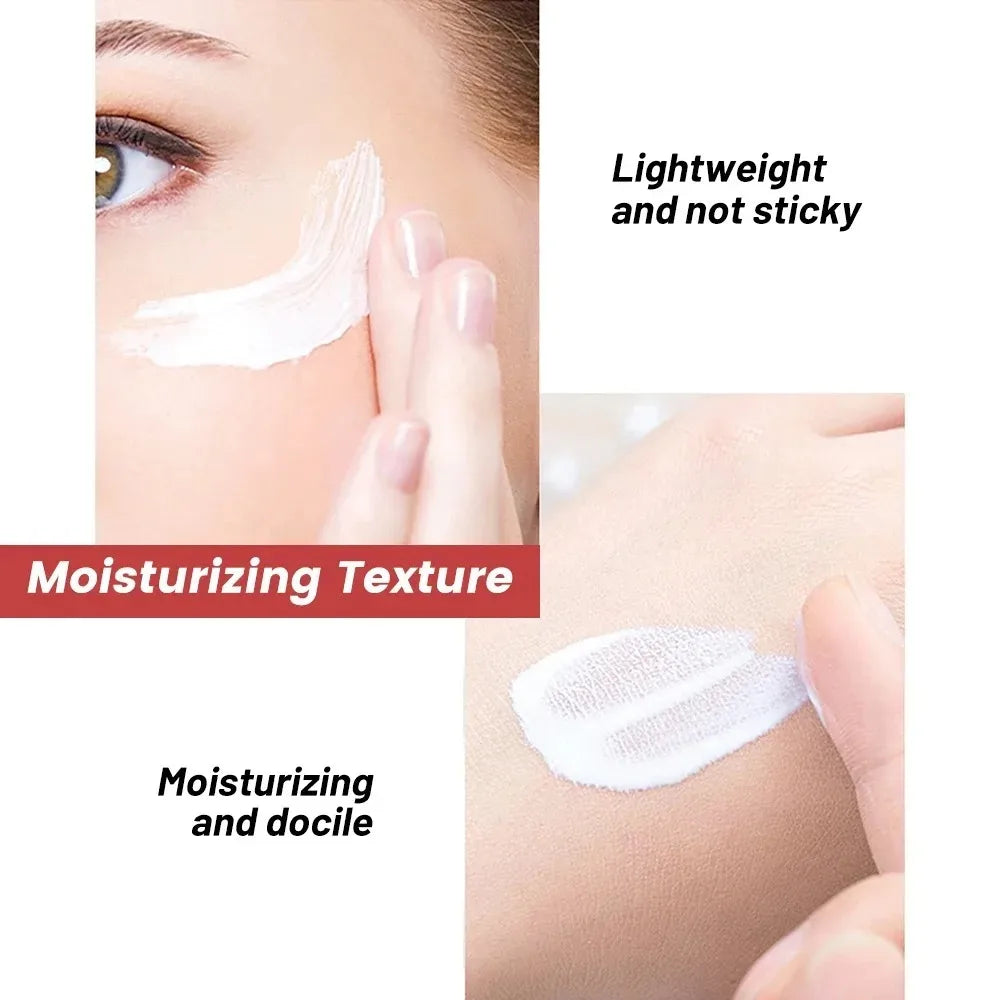 Whitening Freckle Cream – Dark Spot Remover with Niacinamide