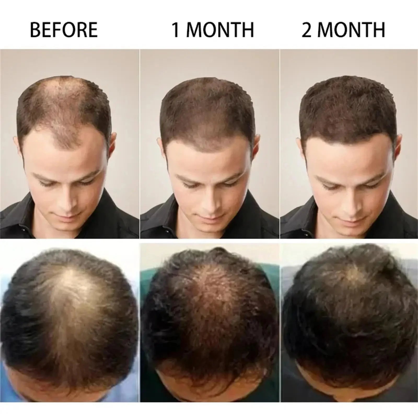 7 Days Batana Hair Growth Serum – Anti-Loss & Repair Treatment
