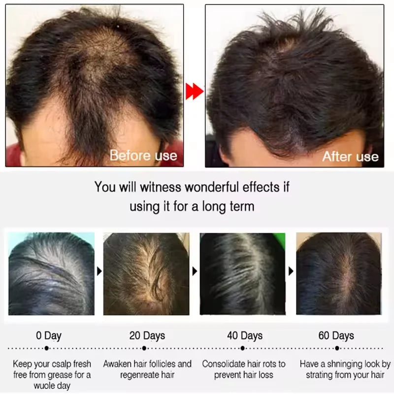 7 Days Batana Hair Growth Serum – Anti-Loss & Repair Treatment