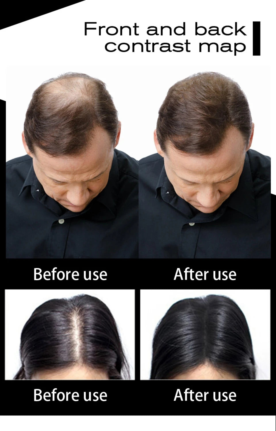 SEVICH Keratin Hair Fiber – 100g Thickening & Hair Loss Concealer