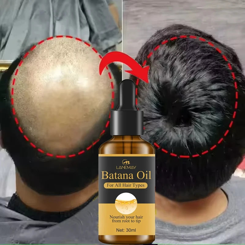 7 Days Batana Hair Growth Serum – Anti-Loss & Repair Treatment