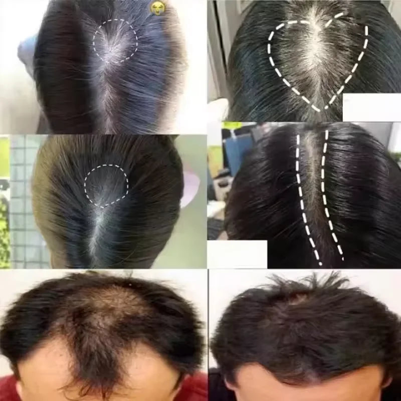 7 Days Batana Hair Growth Serum – Anti-Loss & Repair Treatment