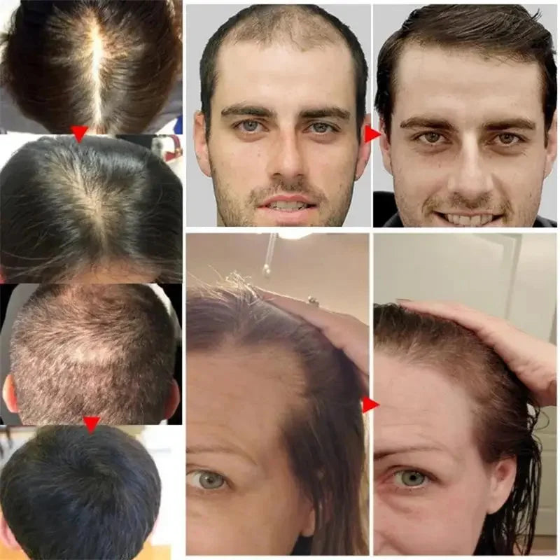 7 Days Batana Hair Growth Serum – Anti-Loss & Repair Treatment