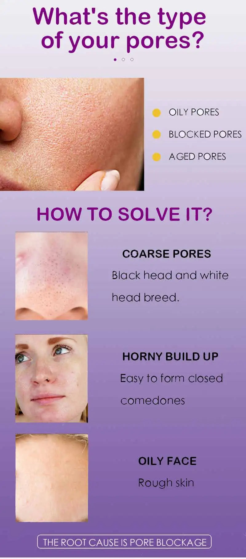 Pore Shrinking Serum – Tightening & Minimizing Essence