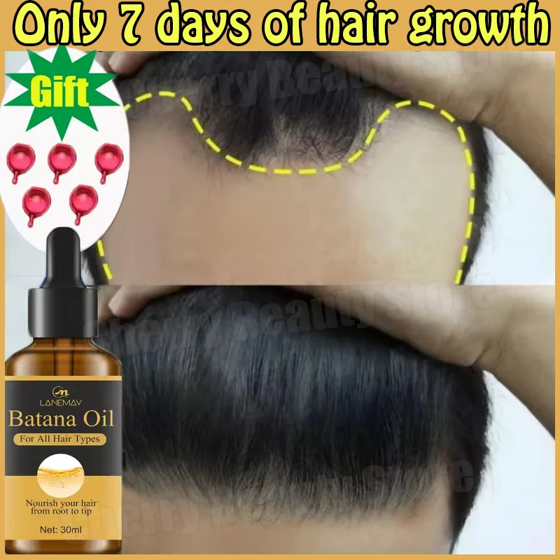 7 Days Batana Hair Growth Serum – Anti-Loss & Repair Treatment