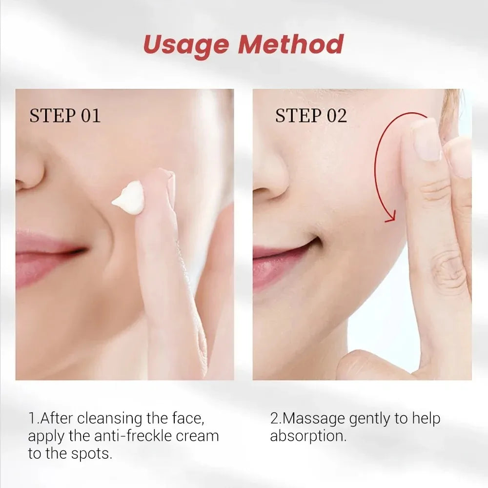 Whitening Freckle Cream – Dark Spot Remover with Niacinamide